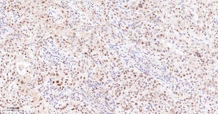JUNB Recombinant Rabbit mAb(bs