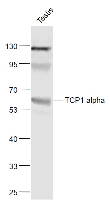 TCP1 alpha Rabbit pAb(bs-12292