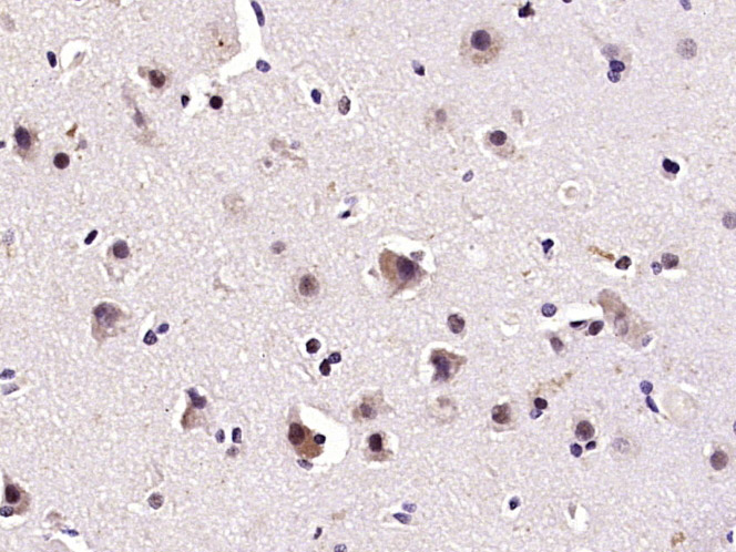 phospho-Smad1 (Ser463) Rabbit 
