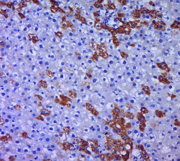 AMY2A Rabbit pAb(bs-3975R)-50u