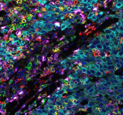 Leica BOND RX 全自动免疫组化及原位杂交染色系统