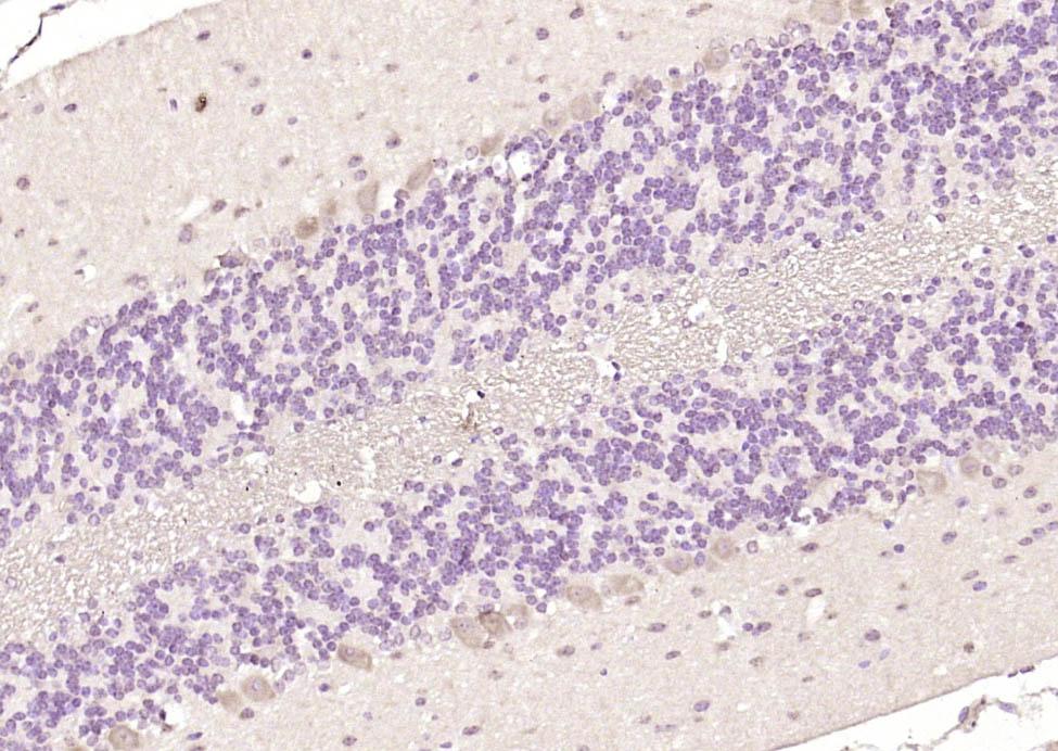 PIK3R5 Rabbit pAb(bs-7467R)-50