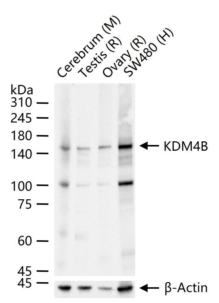 KDM4B Recombinant Rabbit mAb(b