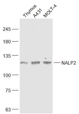 NALP2 Rabbit pAb(bs-6717R)-50u