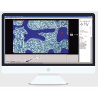 骨组织形态分析系统