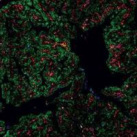 肿瘤免疫微环境（TIME）全景分析（Luminex/ELISA）