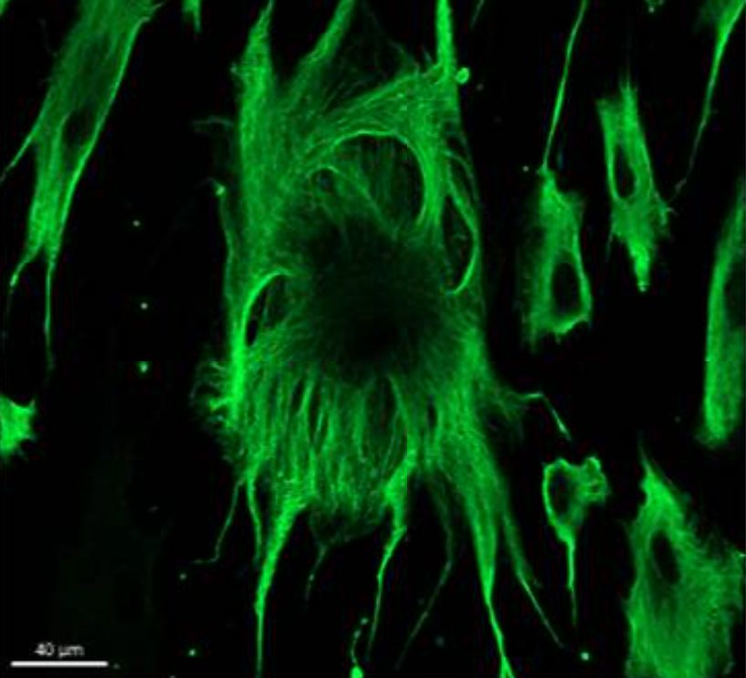 【Vimentin的特异性解析与应用】从细胞骨架“建筑师”到多领域关键标志物