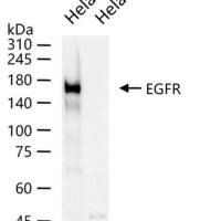 EGFR Knockout Hela Cell Ripa Lysate (Monoclonal)