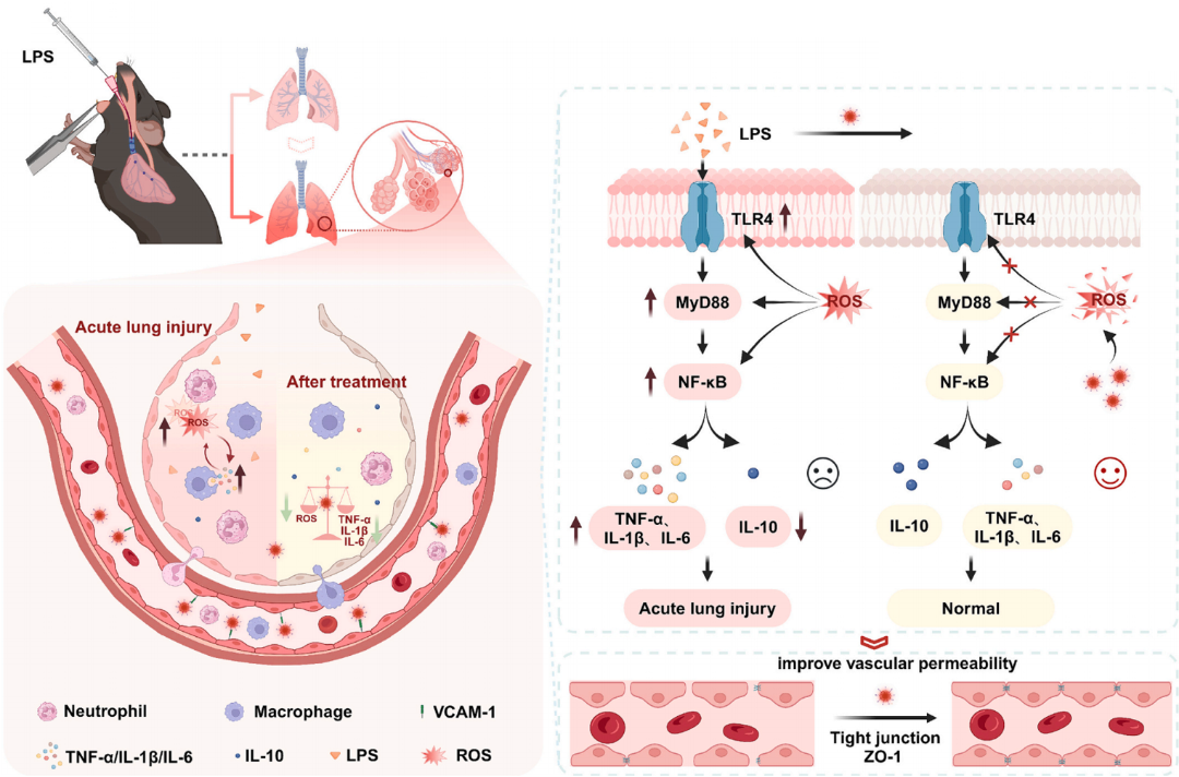 文献速递丨IF=13.19玉研肺部雾化给药装置携手级联纳米酶高效干预急性肺损伤