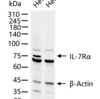 IL7 receptor alpha Knockout Hela Cell Ripa Lysate (Pool)