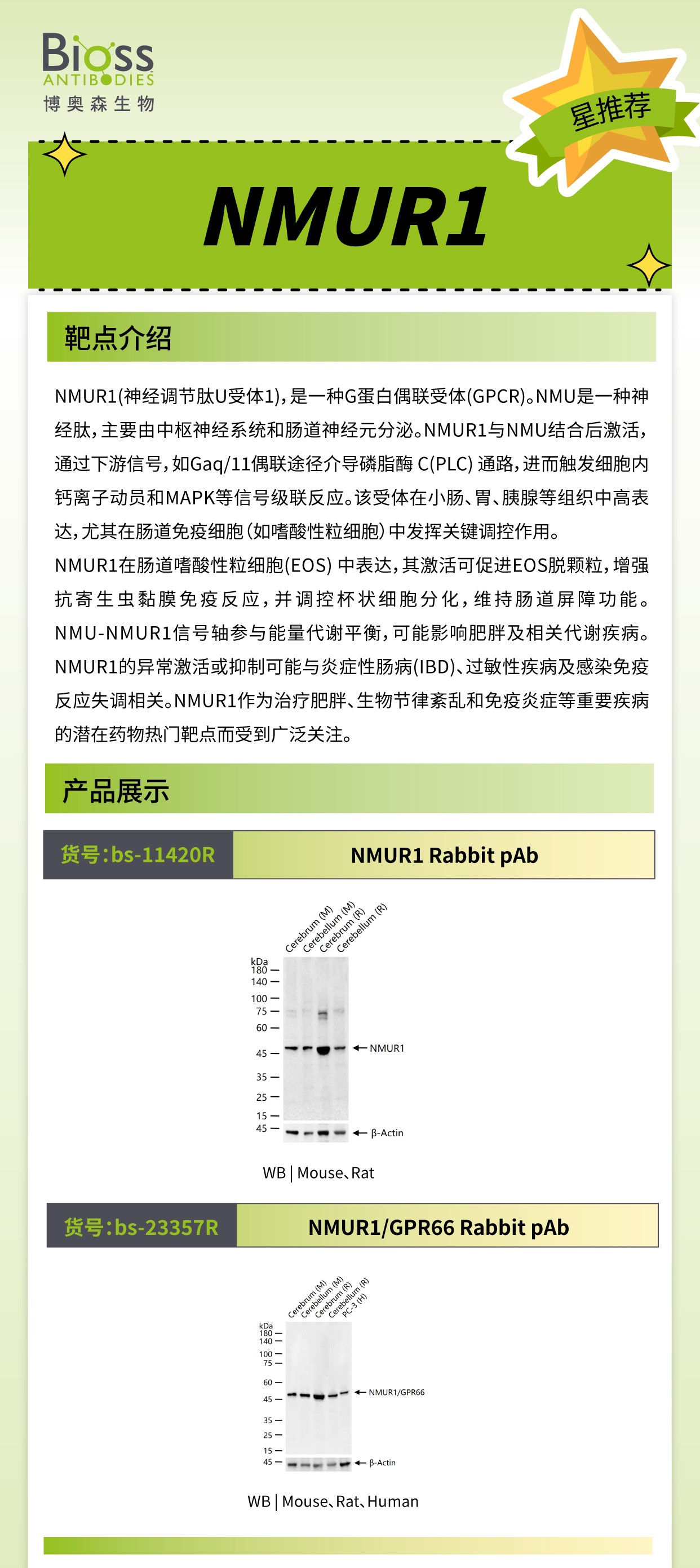 Bioss 星推荐 | NMUR1 抗体