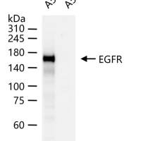 EGFR Knockout A549 Cell Ripa Lysate (Pool)
