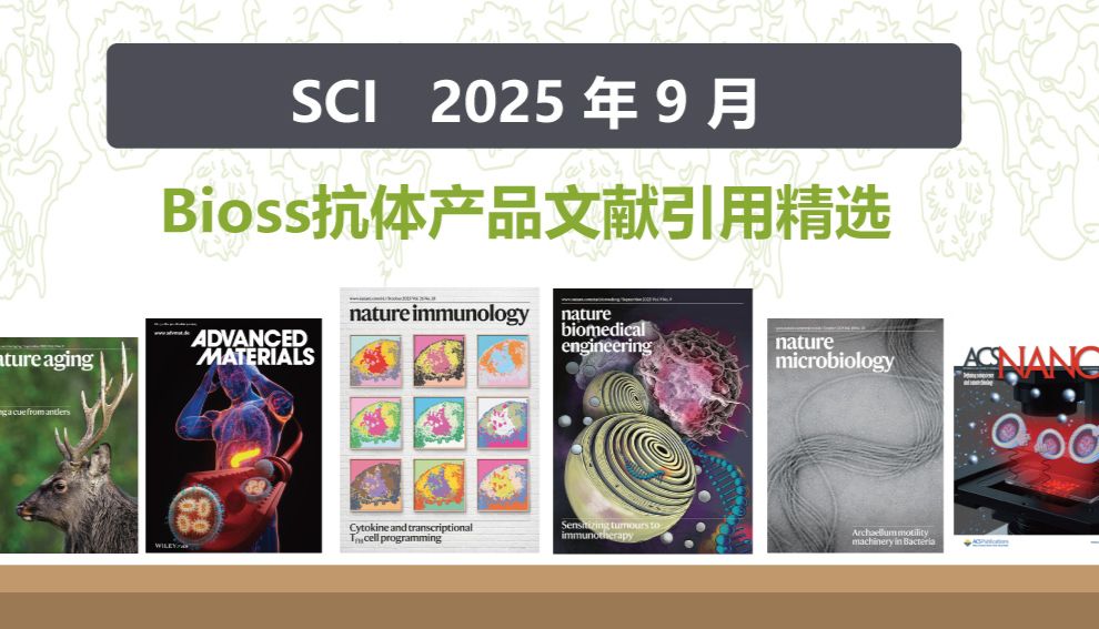【25年9月文献战报】Bioss 抗体新增高分文献精彩呈现