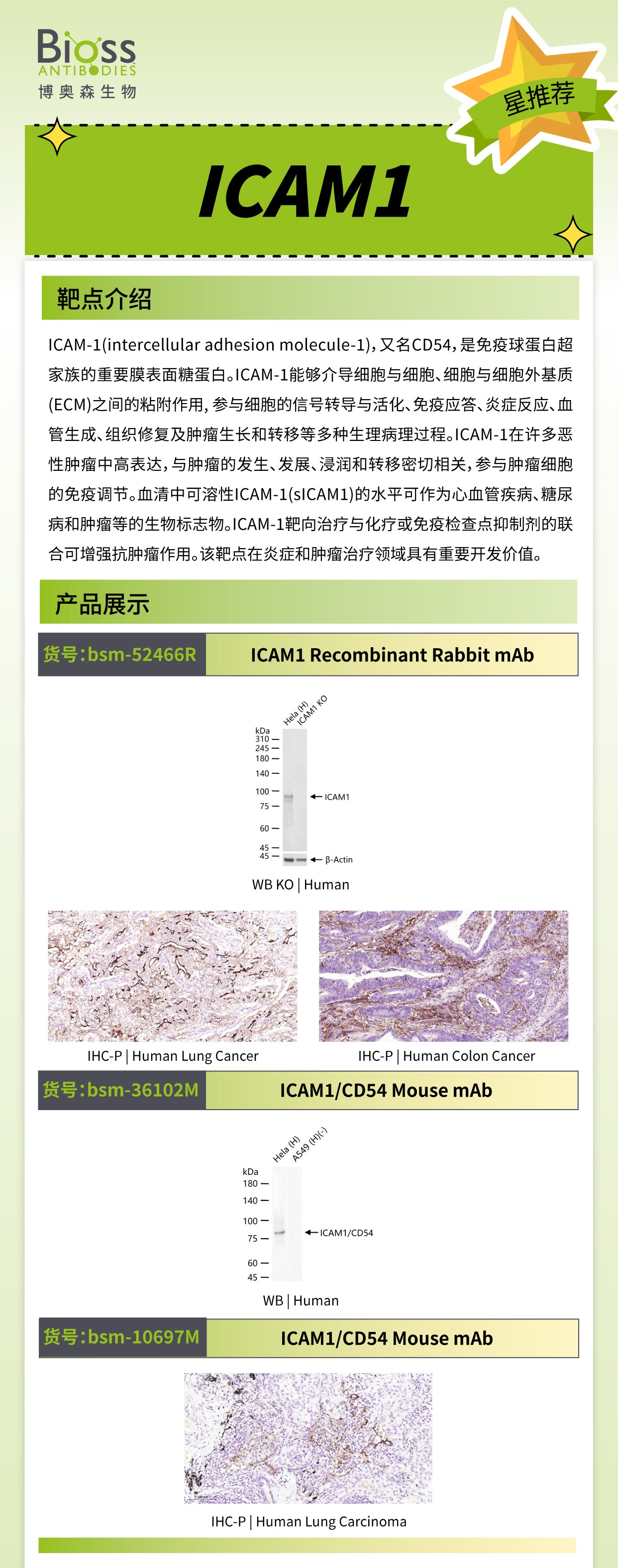 Bioss 星推荐 | ICAM1 抗体