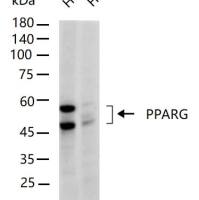 PPAR gamma Knockout Hela Cell Ripa Lysate (Pool)