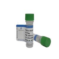 重组人TRPV1蛋白|Recombinant human TRPV1 |protein| TRPV1