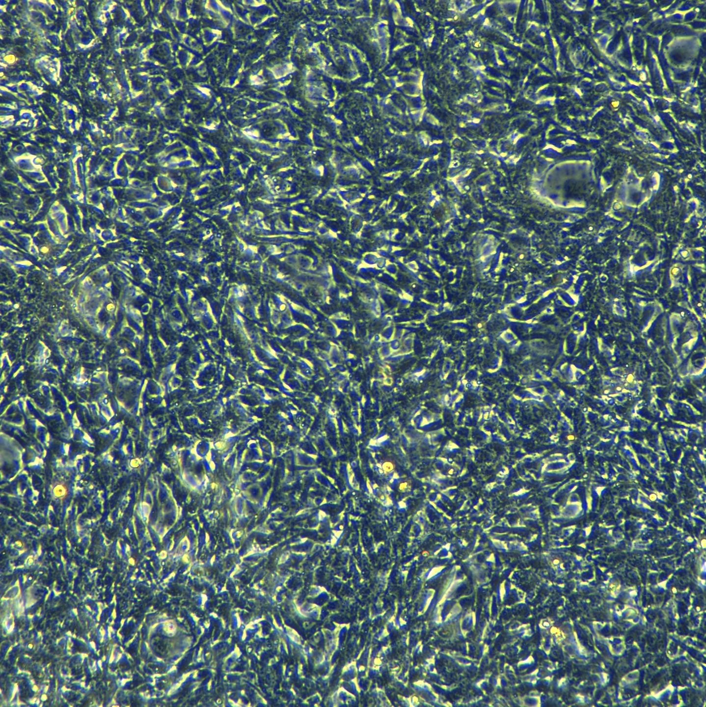 小鼠肺上皮细胞TC-1(Luc1)现货