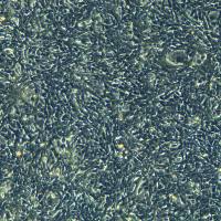 小鼠肺上皮细胞TC-1(Luc1)现货