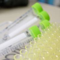 激肽释放酶(冻干粉)