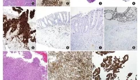 经典病理抗体如何焕发新生？