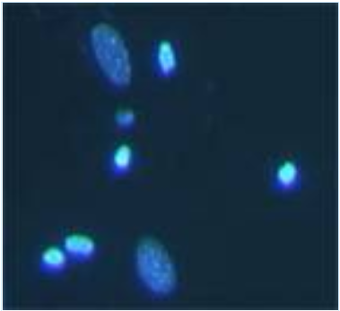 1587863169754613.png 细胞凋亡检测方法