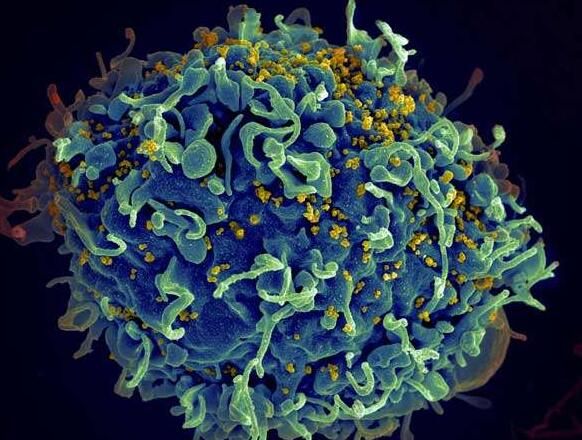 为何HIV感染者患癌风险更高？