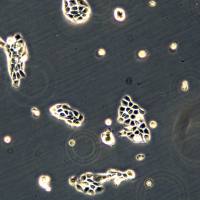 浙江美森-人口腔牙龈鳞状细胞癌 YD-38