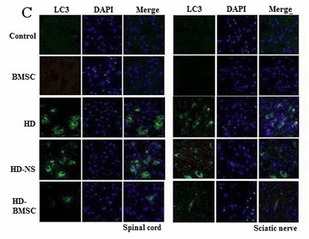 驴封闭血清（Normal Donkey Serum）这么好用