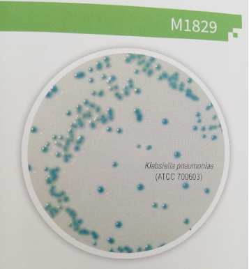 一种筛分碳青霉烯耐药肠杆菌的显色培养基