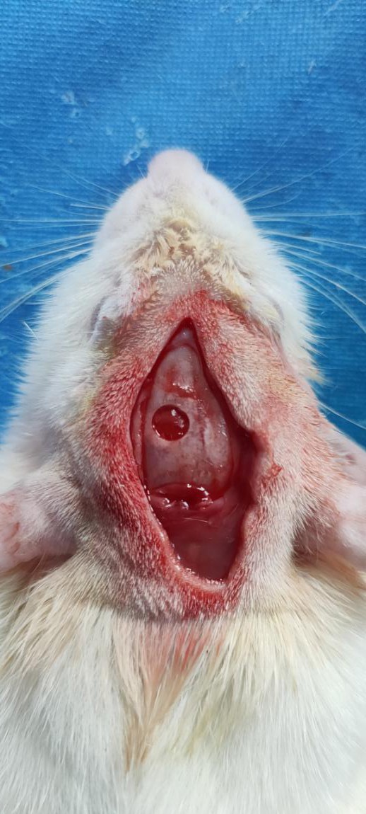 大鼠脑外伤动物模型（TBI）的建立