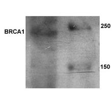 The BRCA1 Antibody (Cat. No. 200160) is used in Western blot to detect BRCA1 in rat ovary tissue lysate (data kindly provided by Dr. Anand Krishnan, University of Calgary).