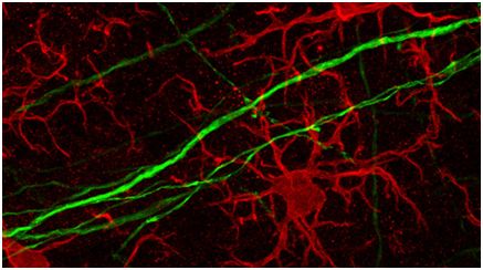 揭示大脑中的免疫记忆