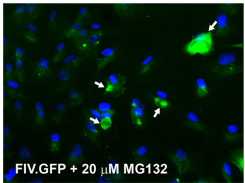 利用基因疗法治疗青光眼有效！蛋白酶体抑制增加眼睛小梁网中的基因运送效率