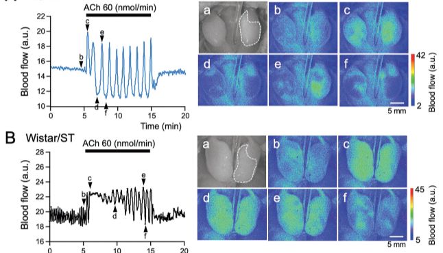 探究水通道蛋白 5（AQP5）在唾液分泌中的作用：OZ-2激光散斑血流成像仪的助力