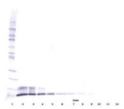 Goat Anti-Human NAP-2 (CXCL7) 