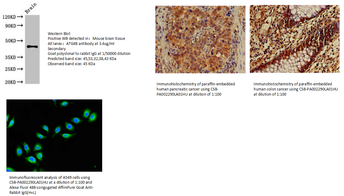 我的后半生——自噬
