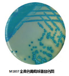 可怕的金黄色葡萄球菌你了解多少