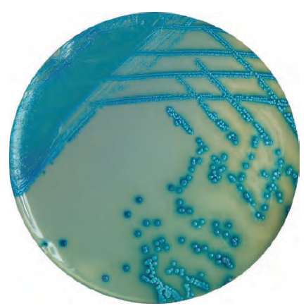 HiMedia的金黄色葡萄球菌显色培养基-威正翔禹|缔一生物