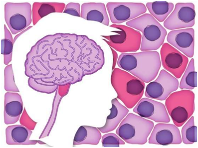 【前沿资讯】Science：重大突破！揭示一种罕见的儿童脑瘤的细胞起源