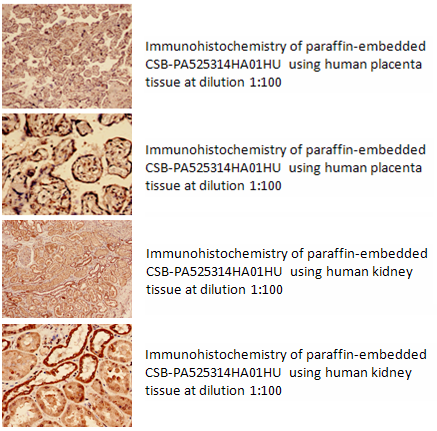 组蛋白去甲基化酶LSD1