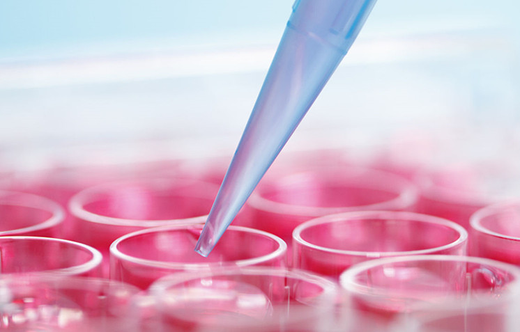 为何细胞培养中要用到胎牛血清？