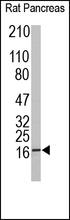 The IL-10 Antibody (Cat. No. 250713) is used in Western blot to detect IL-10 in rat pancreas tissue lysate.