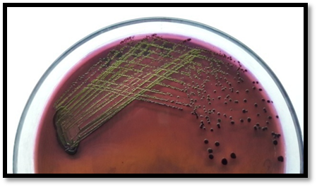 鉴别大肠杆菌，HiCrome优于传统的EMB琼脂