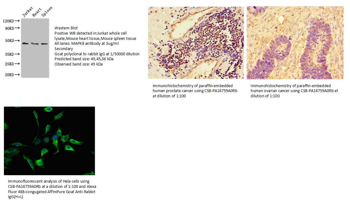我的后半生——自噬
