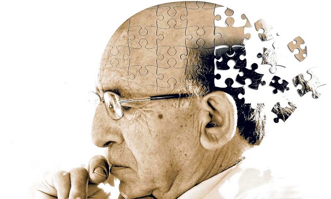 阿尔茨海默病(AD)之淀粉样斑块特异性染色试剂盒