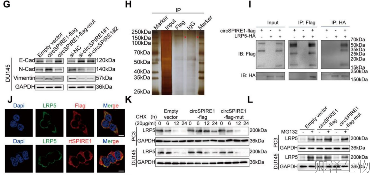 【circRNA翻译】 | 环状RNA编码新型蛋白，成前列腺癌治疗新靶点！