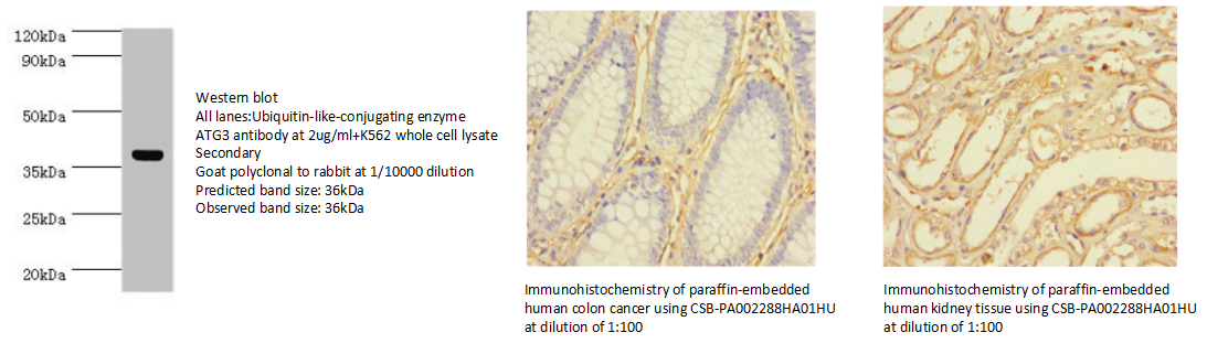 我的后半生——自噬