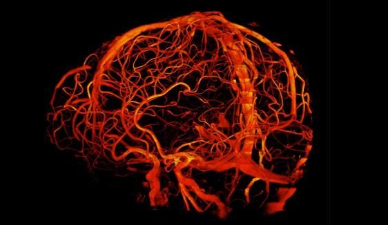 世界上最强核磁共振成像仪正在将人类成像研究推向新的极限