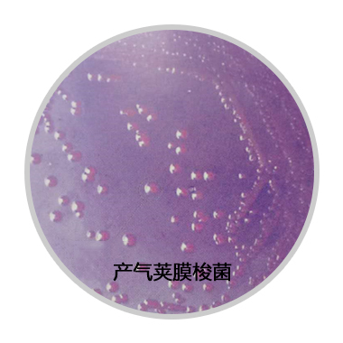 人畜共患病原菌——产气荚膜梭菌