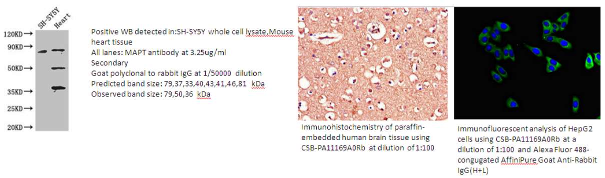 我的后半生——自噬